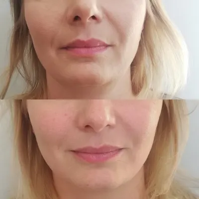 Gabinet Lekarski Medycyny Estetycznej - W Punkt